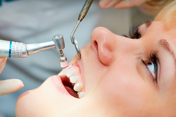 dental checkup